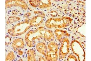 Immunohistochemistry of paraffin-embedded human kidney tissue using ABIN7155729 at dilution of 1:100 (HOXA9 抗体  (AA 1-190))