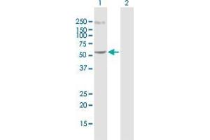 Western Blot analysis of C14orf21 expression in transfected 293T cell line by C14orf21 MaxPab polyclonal antibody. (C14orf21 抗体  (AA 1-536))