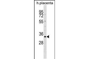 Western blot analysis in human placenta tissue lysates (35ug/lane). (DOK5 抗体  (N-Term))