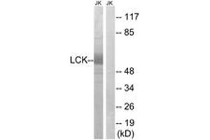 Western blot analysis of extracts from Jurkat cells, using LCK (Ab-59) Antibody. (LCK 抗体  (AA 26-75))