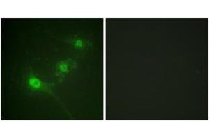 Immunofluorescence analysis of NIH-3T3 cells, using LKB1 (Phospho-Ser428) Antibody.