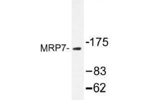 Image no. 1 for anti-ATP-Binding Cassette, Sub-Family C (CFTR/MRP), Member 10 (ABCC10) antibody (ABIN317845) (ABCC10 抗体)
