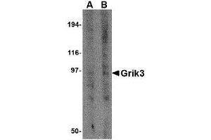 Image no. 1 for anti-Glutamate Receptor, Ionotropic, Kainate 3 (GRIK3) (N-Term) antibody (ABIN1494385) (GRIK3 抗体  (N-Term))