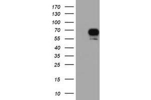 Western Blotting (WB) image for anti-Ribosomal Protein S6 Kinase, 70kDa, Polypeptide 1 (RPS6KB1) antibody (ABIN1500001) (RPS6KB1 抗体)