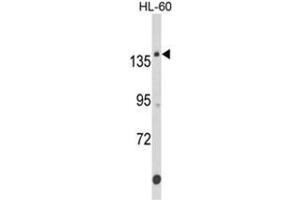 Western blot analysis of FNDC3B Antibody (N-term) in HL-60 cell line lysates (35ug/lane). (FNDC3B 抗体  (N-Term))