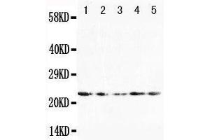 Anti-FGF10 antibody, Western blotting Lane 1: U87 Cell Lysate Lane 2: HELA Cell Lysate Lane 3: A519 Cell Lysate Lane 4: 293T Cell Lysate Lane 5: HELA Cell Lysate (FGF10 抗体  (N-Term))