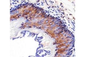 Immunohistochemical analysis of paraffin-embedded mouse esophagus using EGF Receptor antibody at 1:25 dilution.