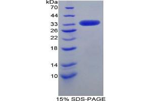 SDS-PAGE analysis of Mouse LRP1 Protein. (LRP1 蛋白)