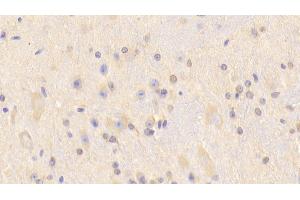 Detection of CARNS1 in Mouse Cerebrum Tissue using Polyclonal Antibody to Carnosine Synthase 1 (CARNS1) (CARNS1 抗体  (AA 623-826))