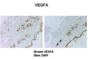 Immunohistochemistry (IHC) image for anti-Vascular Endothelial Growth Factor A (VEGFA) (C-Term) antibody (ABIN2788641)