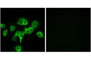 Immunofluorescence analysis of HeLa cells, using CDON Antibody. (CDON 抗体  (AA 511-560))