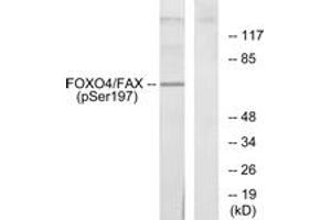 Western blot analysis of extracts from 293 cells treated with serum, using AFX (Phospho-Ser197) Antibody. (FOXO4 抗体  (pSer197))