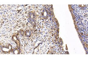 Immunohistochemistry (IHC) image for anti-Mitogen-Activated Protein Kinase 8 (MAPK8) (AA 138-370) antibody (ABIN7439327)