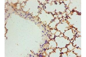 Immunohistochemistry of paraffin-embedded mouse lung tissue using ABIN7179107 at dilution of 1:100