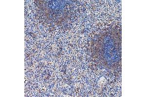 IHC analysis of SETD3 using anti-SETD3 antibody (ABIN7600293).