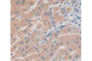 Used in DAB staining on fromalin fixed paraffin- embedded Kidney tissue (PRKD3 抗体  (AA 576-832))