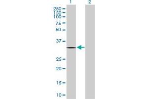Western Blot analysis of ZNF511 expression in transfected 293T cell line by ZNF511 MaxPab polyclonal antibody. (ZNF511 抗体  (AA 1-252))