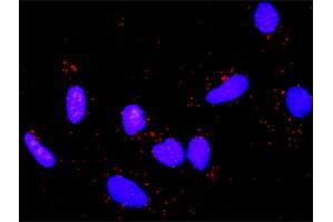 Proximity Ligation Analysis of protein-protein interactions between APC and CTNNB1. (APC 抗体  (AA 1-2843))