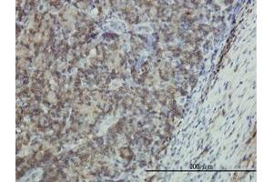 Image no. 1 for anti-Epithelial Membrane Protein 3 (EMP3) (AA 1-164) antibody (ABIN598660) (EMP3 抗体  (AA 1-164))