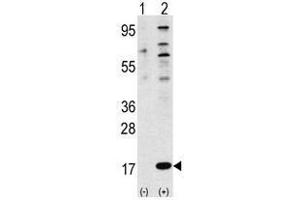 Image no. 2 for anti-Finkel-Biskis-Reilly Murine Sarcoma Virus (FBR-MuSV) Ubiquitously Expressed (FAU) (N-Term) antibody (ABIN357135) (FAU 抗体  (N-Term))