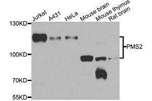 Western blot analysis of extracts of various cell lines, using PMS2 antibody. (PMS2 抗体)