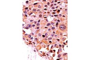 Image no. 1 for anti-Protein Phosphatase 3, Catalytic Subunit, alpha Isoform (PPP3CA) (N-Term) antibody (ABIN360808)