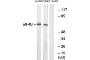 Western blot analysis of extracts from HepG2/HuvEc cells, using eIF4B (Ab-422) Antibody. (EIF4B 抗体  (AA 388-437))