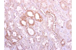 IHC-P Image Ribophorin I antibody [C2C3], C-term detects Ribophorin I protein at cytoplasm on human normal kidney by immunohistochemical analysis. (RPN1 抗体  (C-Term))
