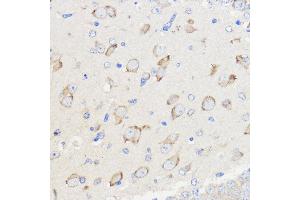 Immunohistochemistry of paraffin-embedded Mouse brain using WBSCR27 Rabbit pAb (ABIN7271366) at dilution of 1:50 (40x lens). (WBSCR27 抗体  (AA 1-245))