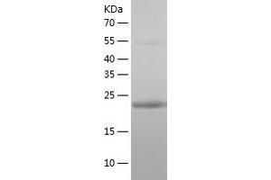 Lin-7 Homolog B (LIN7B) (AA 1-207) protein (His tag)