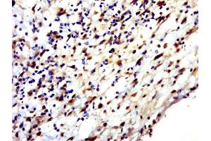 Paraformaldehyde-fixed, paraffin embedded human skin, Antigen retrieval by boiling in sodium citrate buffer (pH6. (HENMT1 抗体  (AA 1-100))