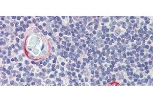 Rabbit Anti-CPXCR1 Antibody Catalog Number: arp39743 Paraffin Embedded Tissue: Human Tymus Antibody Concentration: 10 ug/ml (CPXCR1 抗体  (Middle Region))
