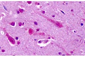Anti-GRM7 / MGLUR7 antibody IHC staining of human brain, cortex.