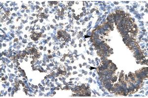 Immunohistochemistry (IHC) image for anti-Estrogen-Related Receptor gamma (ESRRG) (Middle Region) antibody (ABIN2777400)