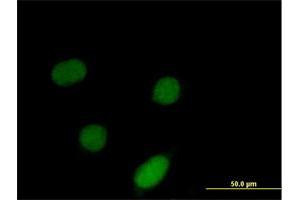 Immunofluorescence of purified MaxPab antibody to ID3 on HeLa cell. (ID3 抗体  (AA 1-119))