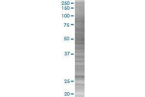 CDKN1B transfected lysate. (CDKN1B 293T Cell Transient Overexpression Lysate(Denatured))