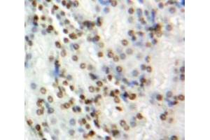 #VALUE! (BRCA1 抗体  (AA 1524-1781))