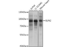 Western blot analysis of extracts of various cell lines, using SUN2 antibody (ABIN7270136) at 1:1000 dilution. (SUN2 抗体)