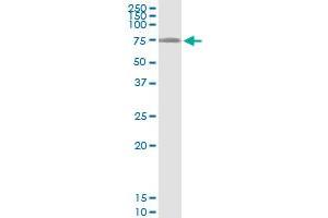 Immunoprecipitation of LARP6 transfected lysate using anti-LARP6 MaxPab rabbit polyclonal antibody and Protein A Magnetic Bead , and immunoblotted with LARP6 purified MaxPab mouse polyclonal antibody (B01P) . (LARP6 抗体  (AA 1-491))