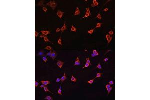 Immunofluorescence analysis of NIH/3T3 cells using CFL1 antibody. (Cofilin 抗体  (AA 1-100))