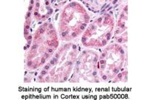 Image no. 1 for anti-Hypoxia Inducible Factor 1, alpha Subunit (Basic Helix-Loop-Helix Transcription Factor) (HIF1A) (AA 432-528) antibody (ABIN363317)