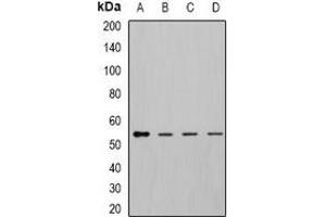 Western blot analysis of DLD expression in MCF7 (A), K562 (B), mouse kidney (C), mouse liver (D) whole cell lysates. (DLD 抗体)