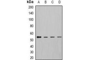 Western blot analysis of DLD expression in MCF7 (A), K562 (B), mouse kidney (C), mouse liver (D) whole cell lysates. (DLD 抗体)