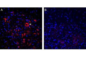 Expression of ASIC2a in rat spinal cord. (ACCN1 抗体  (Intracellular, N-Term))