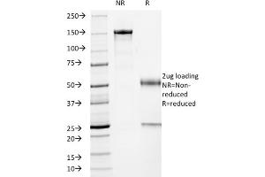 SDS-PAGE Analysis Purified p53 Mouse Monoclonal Antibody (TP53/2719). (p53 抗体)