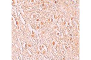 Immunohistochemical staining of human brain cells with PION polyclonal antibody  at 5 ug/mL. (GSAP 抗体  (C-Term))