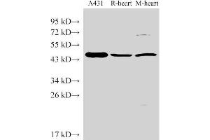 Western Blot analysis of 1)A431, 2)Rat heart, 3)Mouse heart using SERPINB2 Polyclonal Antibody at dilution of 1:1000 (SERPINB2 抗体)