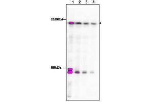 Western Blotting (WB) image for anti-TAF1 RNA Polymerase II, TATA Box Binding Protein (TBP)-Associated Factor, 250kDa (TAF1) (C-Term) antibody (ABIN233826)