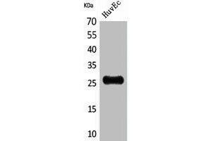 Western Blot analysis of HuvEc cells using CacyBP Polyclonal Antibody. (CACYBP 抗体  (C-Term))