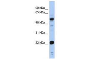 Image no. 1 for anti-Cysteine and Glycine-Rich Protein 1 (CSRP1) (AA 71-120) antibody (ABIN6742467)